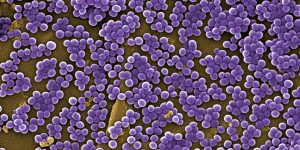 Microscopic image of MRSA, purple dots clustered together on dark ochre background.